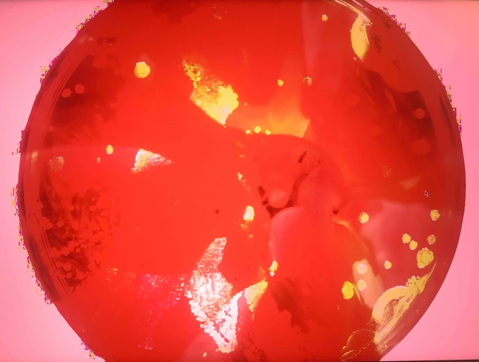 MIRfestival 2025 my heart as an antidote