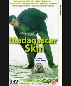 ΜΑΝΤΑΓΚΑΣΚΑΡ ΣΚΙΝ
