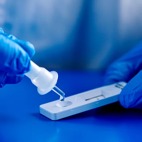 Δωρεάν rapid test και στα έξι Δημοτικά Ιατρεία του Δήμου Αθηναίων