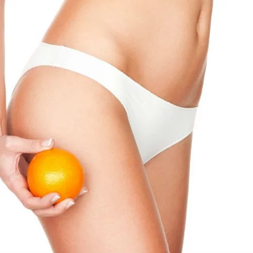 Σπίτι VS Ιατρείο: Πού και πώς να «χτυπήσετε» την κυτταρίτιδα 