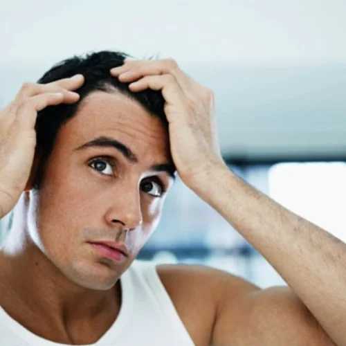 Κεφάλαιο: Ανδρική τριχόπτωση 