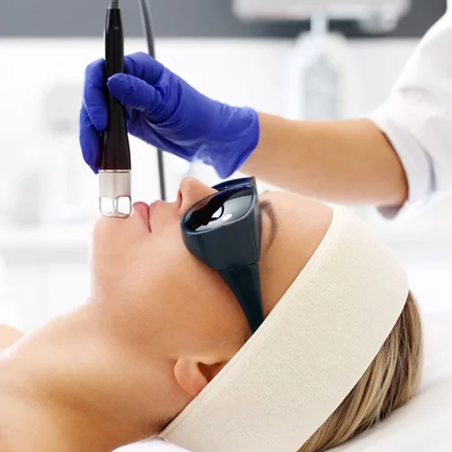 Last chance treatments: Τρεις θεραπείες προσώπου που αγαπούν αποκλειστικά το χειμώνα