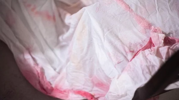 "Salty Tissue": Μια συμμετοχική έκθεση για το τραύμα και την προστασία του σώματος